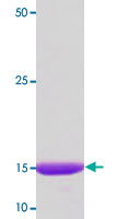 15% SDS-PAGE Stained with Coomassie Blue